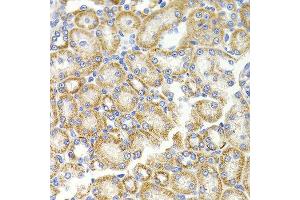 Immunohistochemistry of paraffin-embedded rat kidney using BMP15 antibody at dilution of 1:100 (x40 lens).
