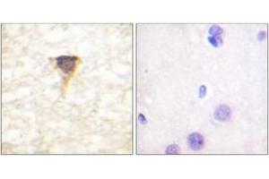 Immunohistochemistry analysis of paraffin-embedded human brain tissue, using CaMK4 (Ab-196/200) Antibody. (CAMK4 antibody  (AA 166-215))