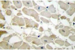 Immunohistochemistry (IHC) analyzes of COL5A1 antibody in paraffin-embedded human heart tissue. (Collagen Type V antibody)