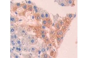 #VALUE! (CRYBB1 antibody  (AA 6-186))