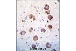 Immunohistochemistry (Paraffin-embedded Sections) (IHC (p)) image for anti-Epidermal Growth Factor (EGF) (AA 690-720), (Center) antibody (ABIN656805)