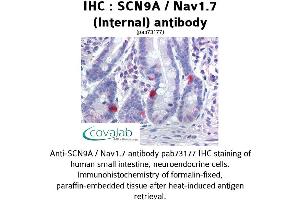 Image no. 1 for anti-Sodium Channel, Voltage-Gated, Type IX, alpha Subunit (SCN9A) (AA 460-510), (Internal Region) antibody (ABIN1739064) (SCN9A antibody  (Internal Region))