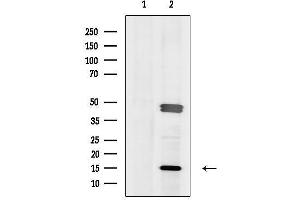 anti-Oral Cancer Overexpressed 1 (ORAOV1) (Internal Region) antibody