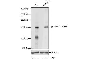 Western blot analysis of extracts of various cell lines, using Phospho-NEDD4L-S448 antibody (ABIN7266883) at 1:1000 dilution. (NEDD4-2 antibody  (pSer448))
