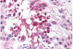 Human Testis: Formalin-Fixed, Paraffin-Embedded (FFPE) (DNAL1 antibody  (C-Term))