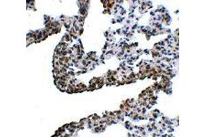 Immunohistochemistry of PCDH12 in rat lung tissue with PCDH12 polyclonal antibody  at 5 ug/mL .