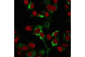 Immunofluorescence Analysis of PFA-fixed HepG2 cells labeling AFP using AFP Mouse Monoclonal Antibody (C2 + C3 + MBS-12) followed by Goat anti-Mouse IgG-CF488 (Green).