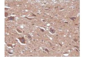 Figure. (CAMK2A antibody  (AA 1-478))