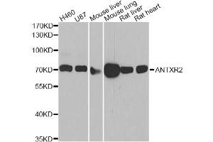Western blot analysis of extracts of various cell lines, using ANTXR2 antibody (ABIN5975032) at 1/1000 dilution. (ANTXR2 antibody)