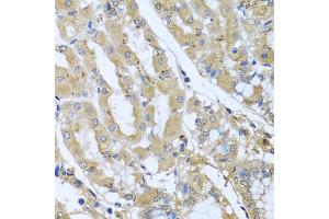 Immunohistochemistry of paraffin-embedded human stomach using STX7 antibody (ABIN5974647) at dilution of 1/100 (40x lens). (Syntaxin 7 antibody)
