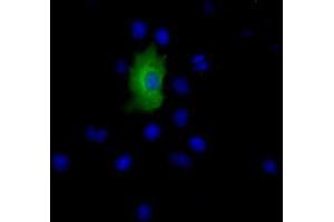 Anti-EPHX2 mouse monoclonal antibody (ABIN2452988) immunofluorescent staining of COS7 cells transiently transfected by pCMV6-ENTRY EPHX2 (RC202489). (EPHX2 antibody)