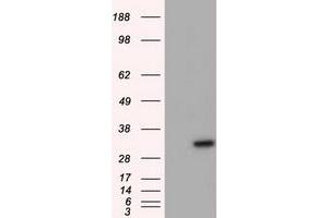 Western Blotting (WB) image for anti-Nitrilase Family, Member 2 (NIT2) antibody (ABIN1499740) (NIT2 antibody)