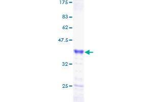 NUPR1 Protein (AA 1-82) (GST tag)