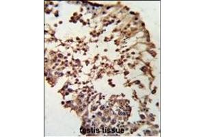 Immunohistochemistry (Paraffin-embedded Sections) (IHC (p)) image for anti-Retinoblastoma 1 (RB1) (AA 858-886), (C-Term) antibody (ABIN652516)
