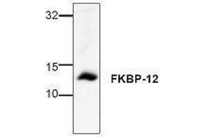 Image no. 1 for anti-FK506 Binding Protein 1A, 12kDa (FKBP1A) antibody (ABIN127265)