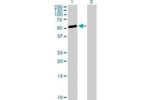 Western Blotting (WB) image for anti-Transforming Growth Factor beta 1 Induced Transcript 1 (TGFB1I1) (AA 1-444) antibody (ABIN520872)