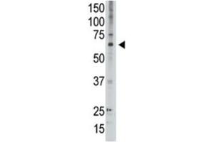 Western Blotting (WB) image for anti-Melanoma Antigen Family D, 2 (MAGED2) antibody (ABIN3002534) (MAGED2 antibody)