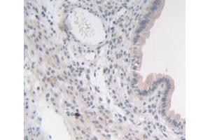 IHC-P analysis of Mouse Uterus Tissue, with DAB staining. (SYN1 antibody  (AA 113-420))