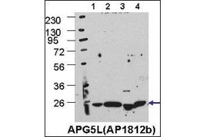 Western Blotting (WB) image for anti-ATG5 Autophagy Related 5 (ATG5) (AA 209-238), (C-Term) antibody (ABIN388519)