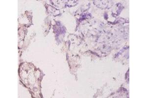 Immunohistochemistry of paraffin-embedded human placenta tissue using ABIN7157894 at dilution of 1:20 (Laminin gamma 1 antibody  (AA 1333-1607))