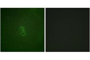 Immunofluorescence analysis of NIH-3T3 cells, using BCL-XL (Phospho-Thr47) Antibody. (BCL2L1 antibody  (pThr47))