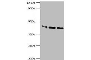 Western blot All lanes: Apolipoprotein L1 antibody at 10 μg/mL Lane 1: A549 whole cell lysate Lane 2: Hela whole cell lysate Lane 3: HepG2 whole cell lysate Secondary Goat polyclonal to rabbit IgG at 1/10000 dilution Predicted band size: 44, 46, 43 kDa Observed band size: 44 kDa (APOL1 antibody  (AA 179-398))
