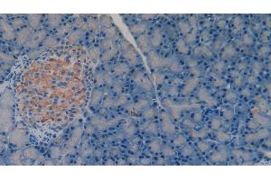Detection of MMP3 in Rat Pancreas Tissue using Polyclonal Antibody to Matrix Metalloproteinase 3 (MMP3) (MMP3 antibody  (AA 278-450))