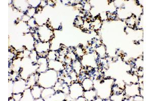 Anti- ITGA2B Picoband antibody, IHC(P) IHC(P): Mouse Lung Tissue (Integrin Alpha2b antibody  (C-Term))