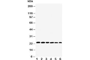 Western blot testing of SNAP23 antibody and Lane 1:  rat spleen;  2: (r) testis;  3: (r) ovary;  4: human HeLa;  5: (h) MCF-7;  6: (h) SKOV;  Expected size: ~23KD (SNAP23 antibody  (C-Term))