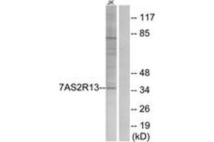 Western Blotting (WB) image for anti-Taste Receptor, Type 2, Member 13 (TAS2R13) (AA 123-172) antibody (ABIN2891090) (TAS2R13 antibody  (AA 123-172))