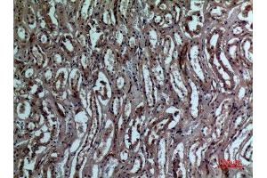 Immunohistochemistry (IHC) analysis of paraffin-embedded Human Kidney, antibody was diluted at 1:100. (BNIP3 antibody  (Internal Region))