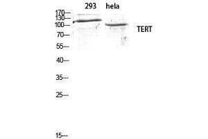 Western Blotting (WB) image for anti-Telomerase Reverse Transcriptase (TERT) (Tyr1510) antibody (ABIN3187227) (TERT antibody  (Tyr1510))