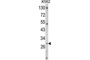 Western Blotting (WB) image for anti-CD40 Ligand (CD40LG) antibody (ABIN3002678)