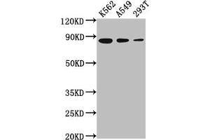 Western Blot Positive WB detected in: K562 whole cell lysate, A549 whole cell lysate, 293T whole cell lysate All lanes: XRCC5 antibody at 1:2000 Secondary Goat polyclonal to rabbit IgG at 1/50000 dilution Predicted band size: 83 kDa Observed band size: 83 kDa (Recombinant XRCC5 antibody)