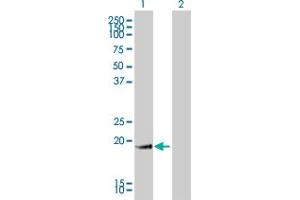 Western Blot analysis of GKN1 expression in transfected 293T cell line by GKN1 monoclonal antibody (M01), clone 2E5. (Gastrokine 1 antibody  (AA 21-185))