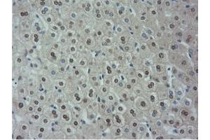 Image no. 5 for anti-5'-Nucleotidase Domain Containing 1 (NT5DC1) antibody (ABIN1499838)