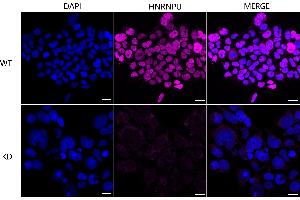 Immunocytochemical staining of HeLa cells using HNRNPUL1 antibody (ABIN7798903), 1:1,000), Top panel: wild-type (WT), Bottom panal: HNRNPUL1 shRNA knockdown (KD).