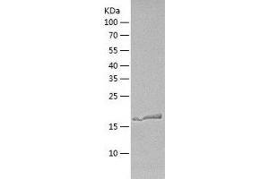 Calcineurin B Protein (CAN) (AA 1-173) (His tag)