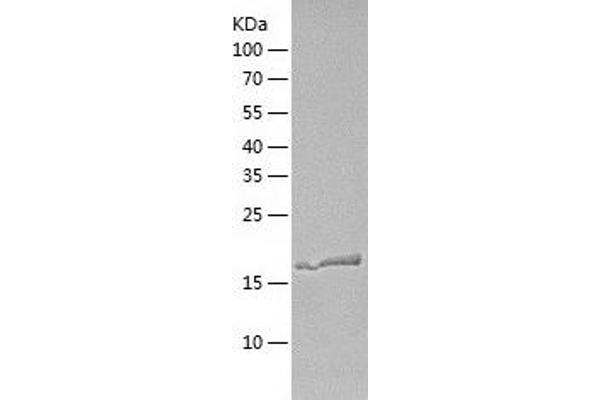 Calcineurin B Protein (CAN) (AA 1-173) (His tag)