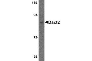 Western Blotting (WB) image for anti-Dapper, Antagonist of beta-Catenin 2 (DACT2) (N-Term) antibody (ABIN1031341) (DACT2 antibody  (N-Term))