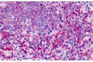 Human Spleen: Formalin-Fixed, Paraffin-Embedded (FFPE) (HCLS1 antibody  (AA 266-356))