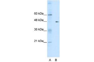 Western Blot showing GDI2 antibody used at a concentration of 1-2 ug/ml to detect its target protein.