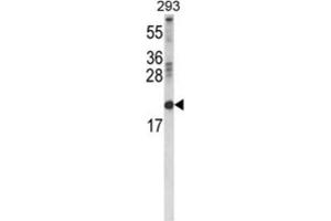 Western Blotting (WB) image for anti-Retinol Binding Protein 2, Cellular (RBP2) antibody (ABIN3004227) (RBP2 antibody)