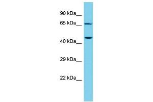 Host: Rabbit Target Name: CTTNBP2NL Sample Type: NCI-H226 Whole Cell lysates Antibody Dilution: 1. (CTTNBP2NL antibody  (N-Term))