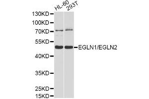Western blot analysis of extracts of various cell lines, using EGLN1/EGLN2 antibody (ABIN5997652) at 1/1000 dilution. (EGLN1 antibody)