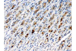 TCP1 beta was detected in paraffin-embedded sections of rat gaster tissues using rabbit anti- TCP1 beta Antigen Affinity purified polyclonal antibody (Catalog # ) at 1 µg/mL.