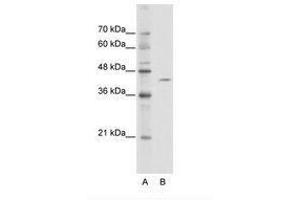 Image no. 1 for anti-Zinc Finger and BTB Domain Containing 26 (ZBTB26) (AA 181-230) antibody (ABIN6736113) (ZBTB26 antibody  (AA 181-230))