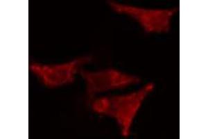 ABIN6266802 staining HeLa cells by IF/ICC.