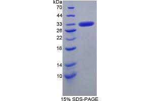 SDS-PAGE analysis of Human CA5B Protein. (CA5B Protein)