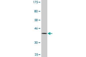 Western Blot detection against Immunogen (36. (DOCK4 antibody  (AA 1867-1966))